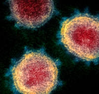 Aggiornamento coronavirus: + 8  positivi nel riminese
