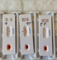 Test sierologici, autorizzati tre laboratori a Rimini