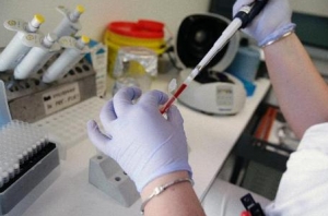 Meningite, una riminese muore a Livorno