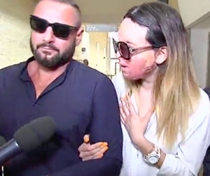 Ragazza sfregiata, Gessica racconta l’aggressione