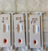 Romagna, arrivati 7mila kit per i test sierologici ai sanitari