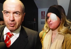 Sfregiata con acido: 10 anni a Tavares, ex fidanzato di Gessica Notaro