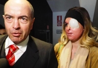 Sfregiata con acido: 10 anni a Tavares, ex fidanzato di Gessica Notaro