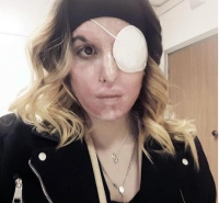 Sfregiata, autolesionismo per l&#039;ex Eddy