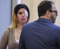 Sfregiata con acido, Gessica in aula